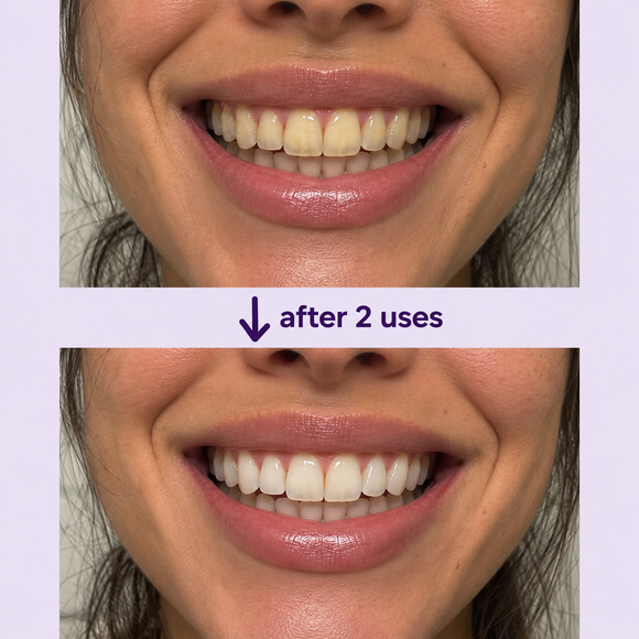 Serovia Purple Toothpaste Tablets tin